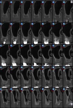 Les maladies des gencives